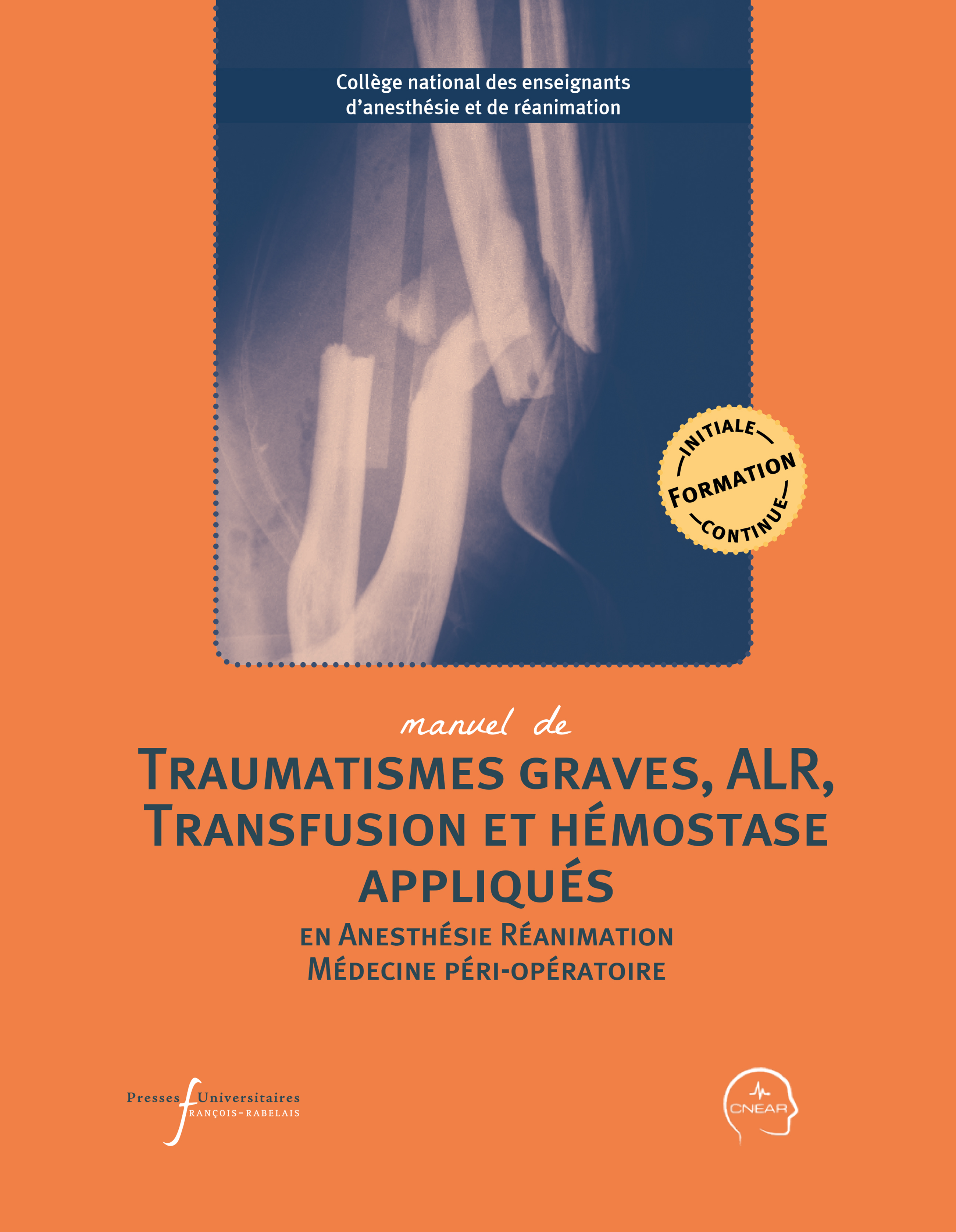 Manuel de traumatismes graves, ALR, transfusion et hémostase appliqués en anesthésie-réanimation et médecine péri-opératoire