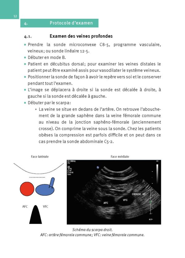 CM-Echographie Doppler vasculaire, Nouvelle édition_Extrait page6