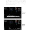 CM-Echographie Doppler vasculaire, Nouvelle édition_Extrait page7