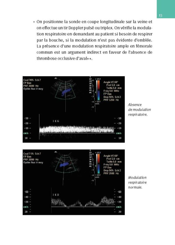 CM-Echographie Doppler vasculaire, Nouvelle édition_Extrait page7