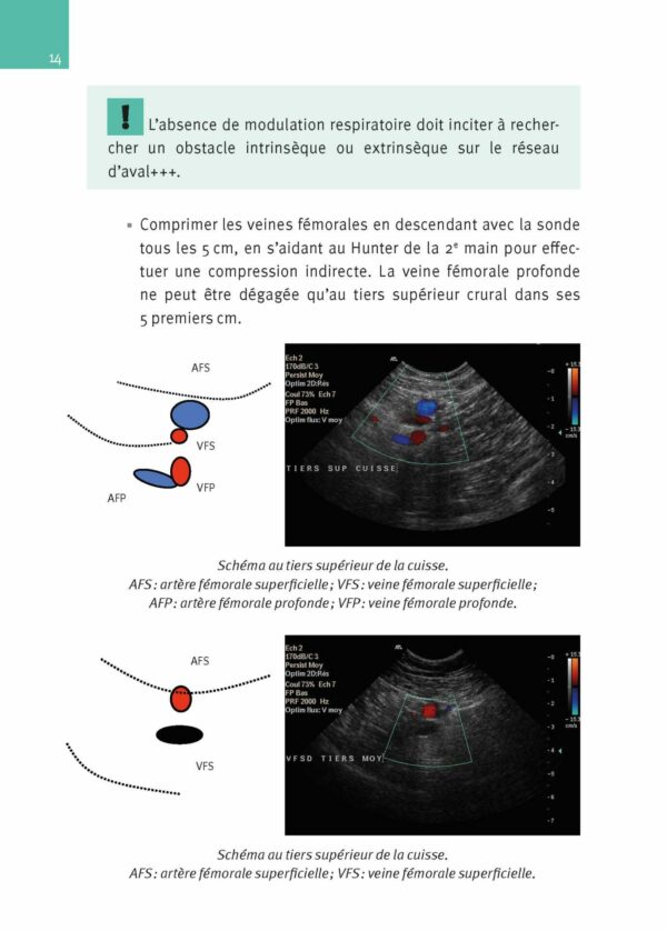 CM-Echographie Doppler vasculaire, Nouvelle édition_Extrait page8