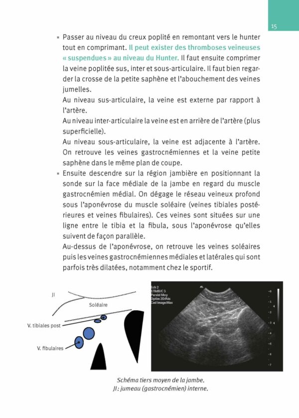 CM-Echographie Doppler vasculaire, Nouvelle édition_Extrait page9